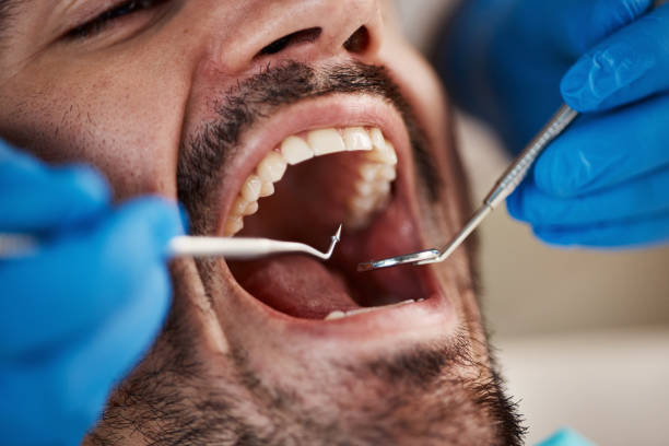 Best Broken or Chipped Tooth Repair in Braddock, VA