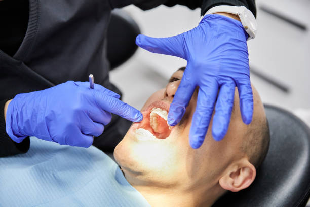 Best Emergency Dental Care for Sports Injuries in Braddock, VA